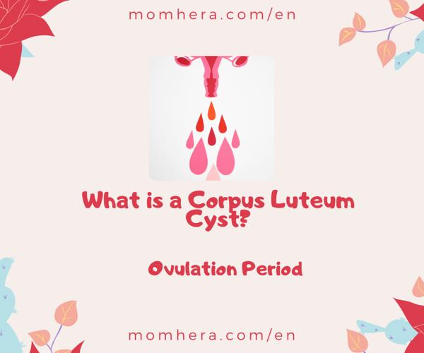 What is a Corpus Luteum Cyst?